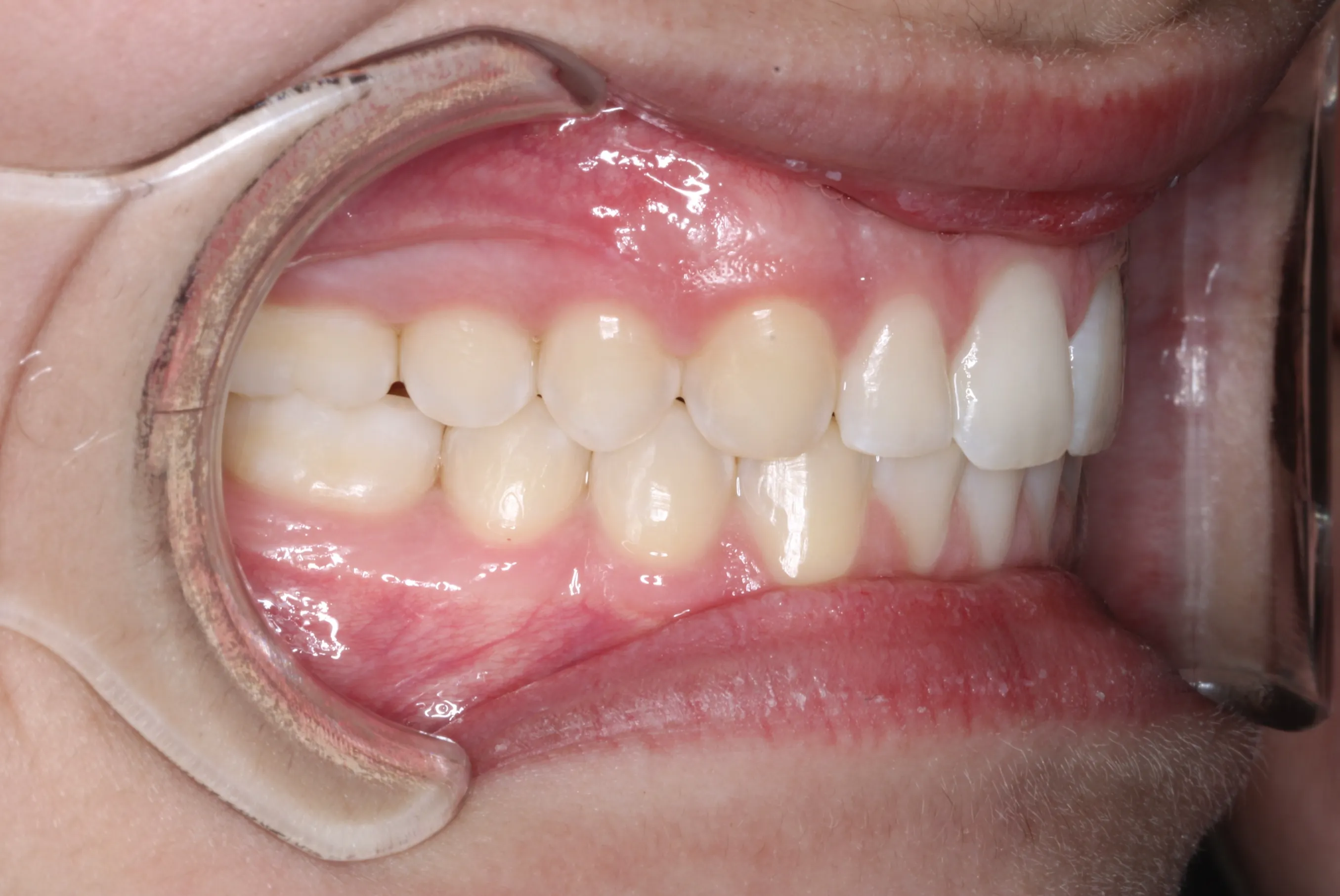 smile-gallery gallery